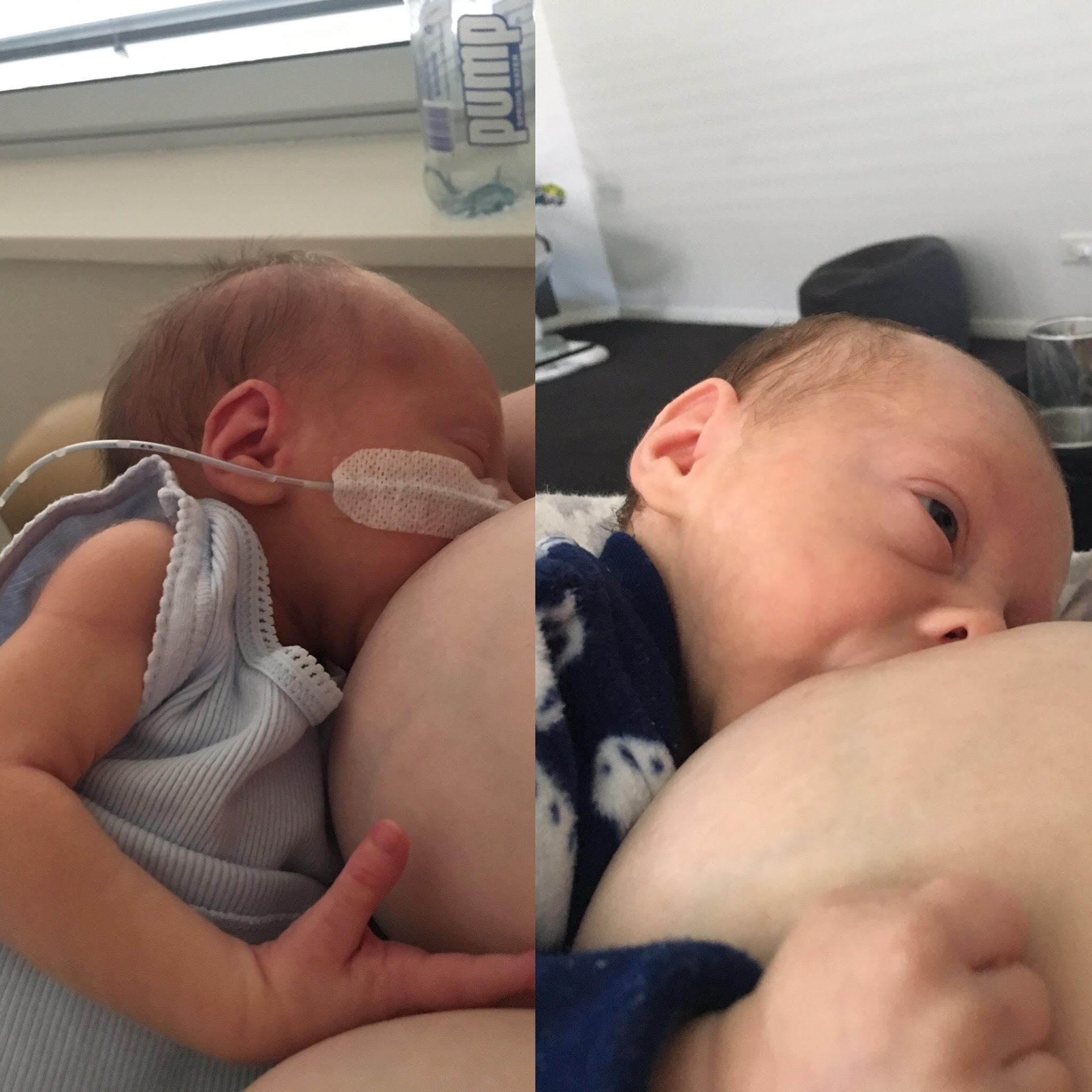 Breastfeeding Tube Feeding Premature Baby